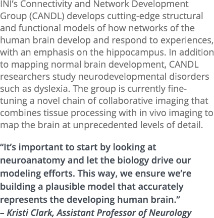 INI’s Connectivity and Network Development Group (CANDL) develops cutting-edge structural and functional models of ho...