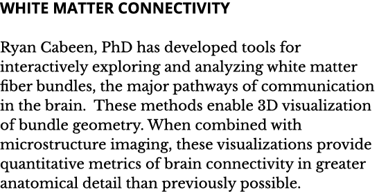 White Matter Connectivity Ryan Cabeen  PhD has developed tools for interactively exploring and analyzing white matter   