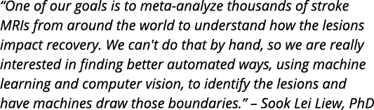  One of our goals is to meta-analyze thousands of stroke MRIs from around the world to understand how the lesions imp   