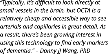  Typically  it s difficult to look directly at small vessels in the brain  but OCTA is a relatively cheap and accessi   