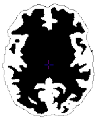 Gray-CSF union