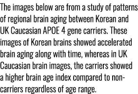The images below are from a study of patterns of regional brain aging between Korean and UK Caucasian APOE 4 gene car...