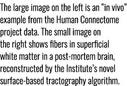 The large image on the left is an “in vivo” example from the Human Connectome project data. The small image on the ri...