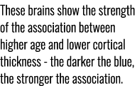 These brains show the strength of the association between higher age and lower cortical thickness the darker the blue...