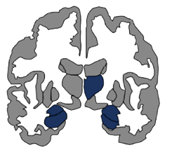 6 CChing_ENIGMA_Figure brains only.psd