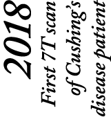 2018 First 7T scan of Cushing’s disease patient