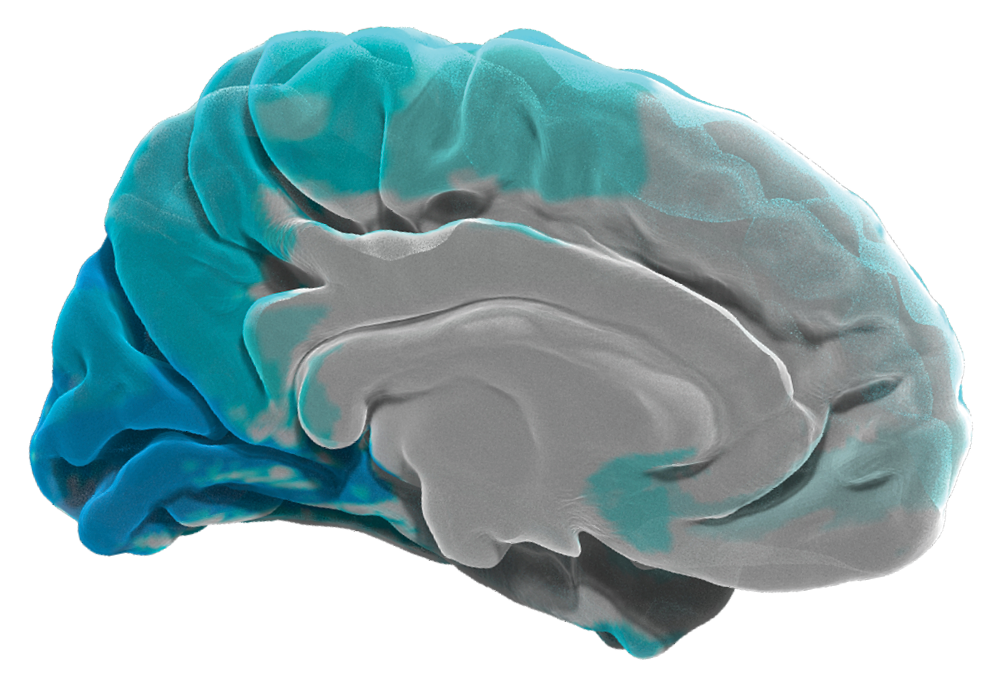 3 ADNI_brain_split_view__enlarged.png