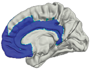 1 Kay Figure1 brains only 1.png