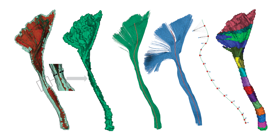 1 MeTA_workflow_report.ai