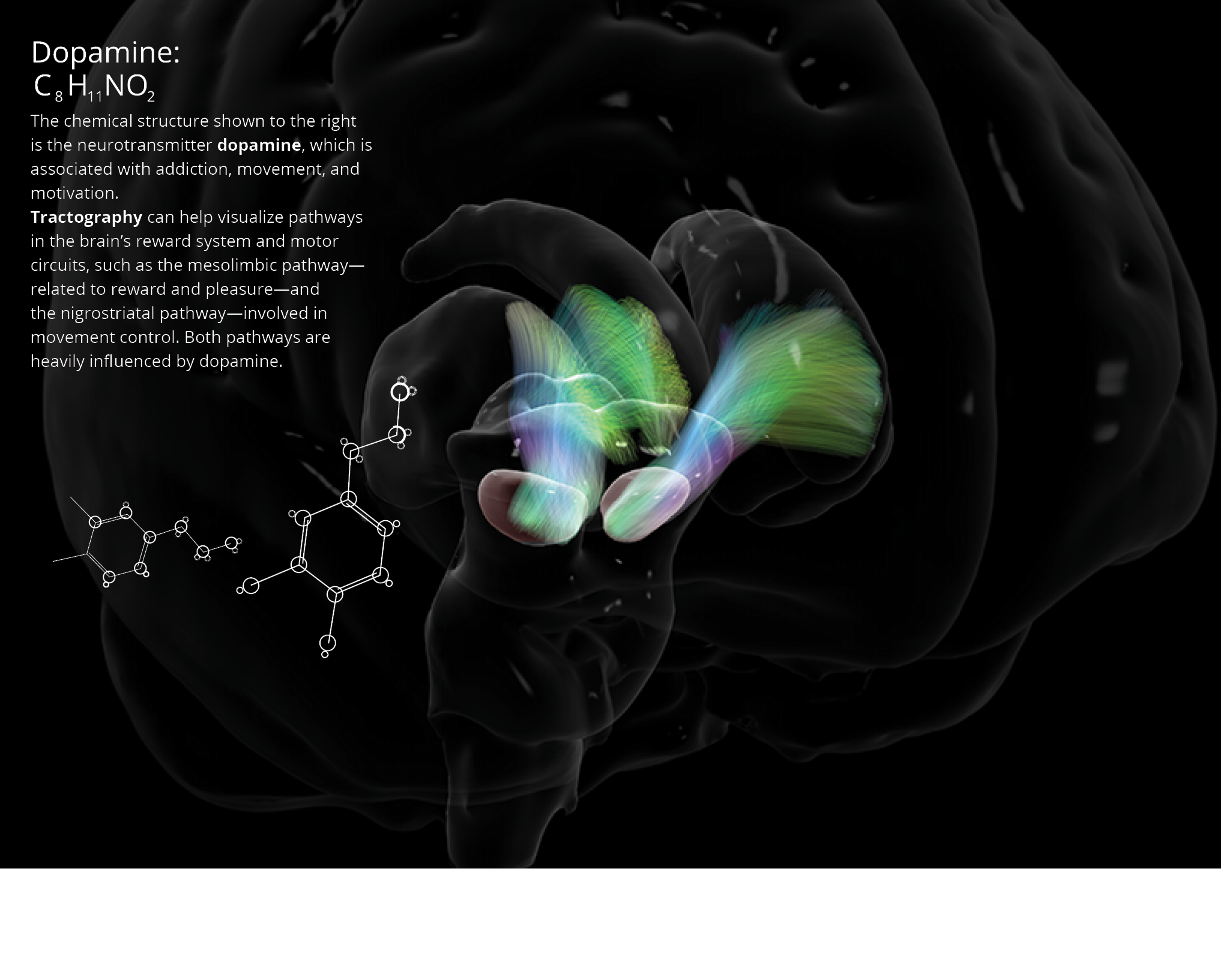 Tractography can help visualize pathways in the brain’s reward system and motor circuits, such as the mesolimbic path...
