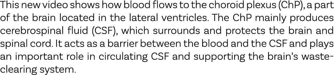 This new video shows how blood flows to the choroid plexus (ChP), a part of the brain located in the lateral ventricl...